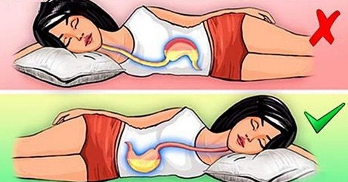 lato sinistro per dormire