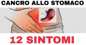 12 sintomi di cancro allo stomaco