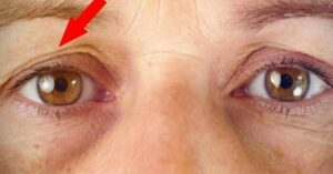 5 modi per stendere le palpebre cadenti e invecchiate