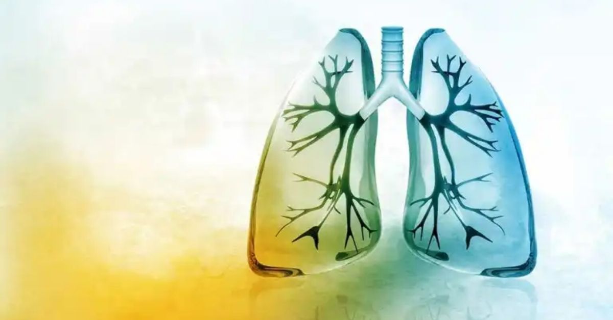 polmoni blu e gialli