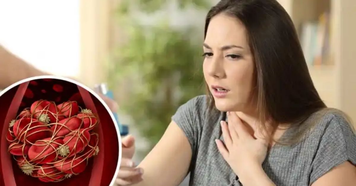 effetti dei coaguli di sangue