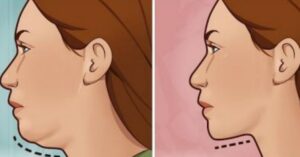 5 esercizi efficaci per eliminare il doppio mento e il grasso del collo