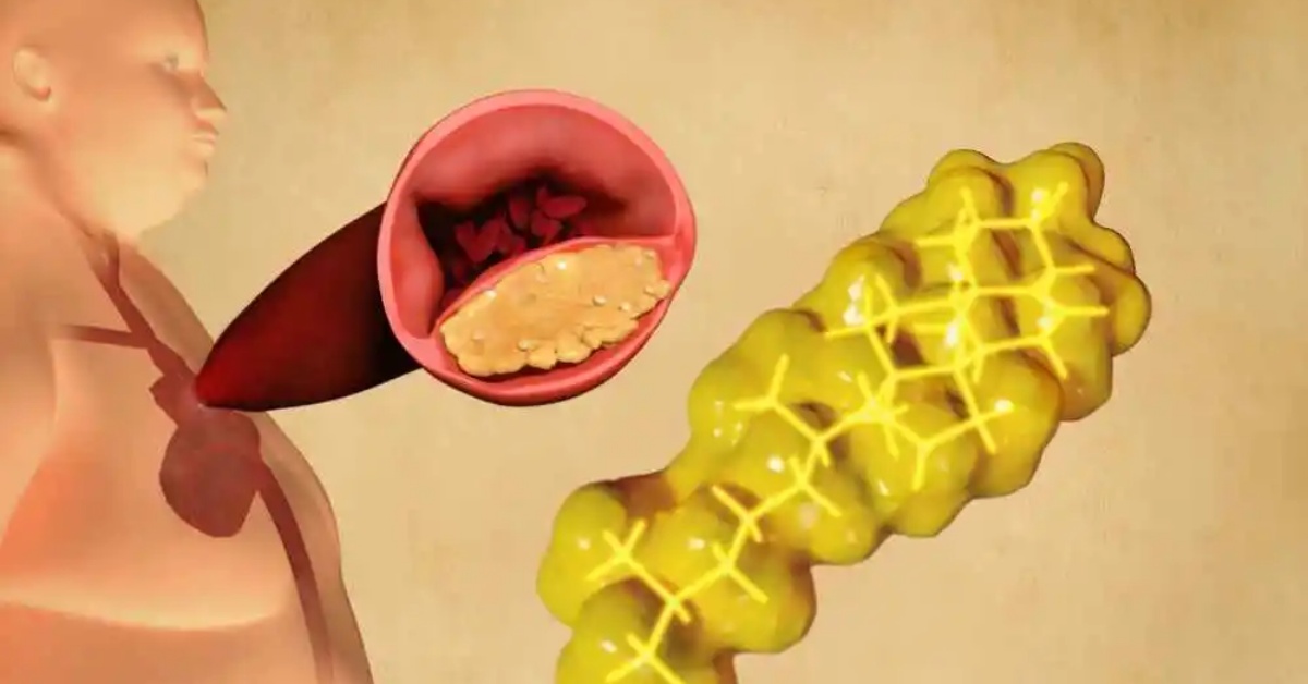 prevenire trigliceridi alti