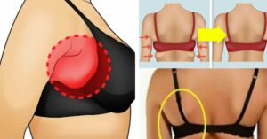 Addio stress da reggiseno! 5 esercizi consigliati