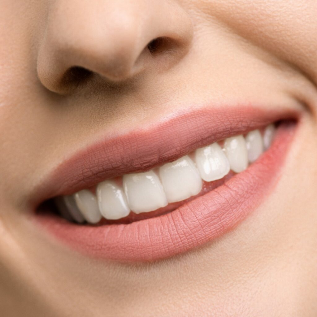 Sorriso denti bianchi