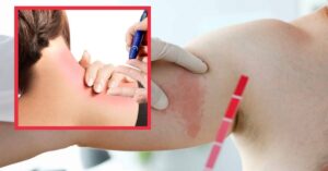 I 5 sintomi del diabete che non devi sottovalutare