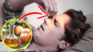 5 rimedi del tutto naturali per contrastare la sinusite