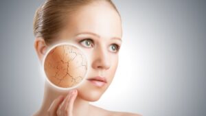 Hai sempre la pelle screpolata? Grazie a questo rimedio non sarà più così!