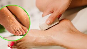 Talloni ruvidi e screpolati? Risolvi con questo formidabile scrub
