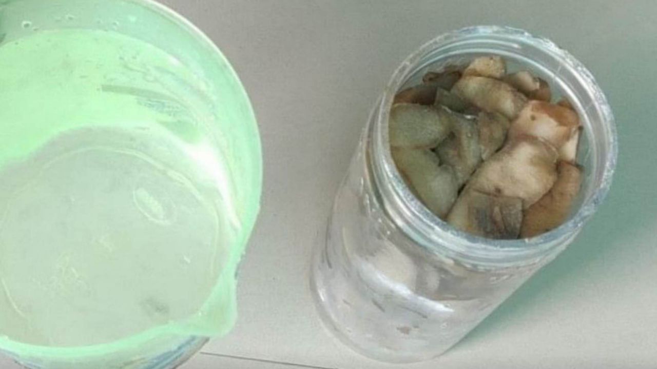 Bucce di patate in barattolo