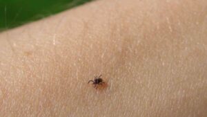 Una zecca ti ha morso? Cosa non devi assolutamente fare