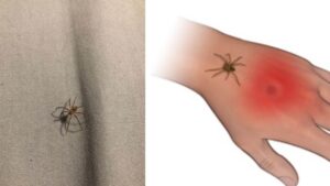 Ragno violino, dove si nasconde in casa e come intervenire subito