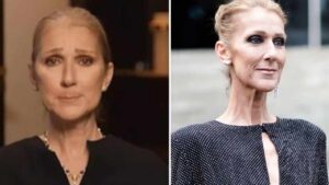 Cos’è la sindrome della persona rigida, la malattia che ha colpito Céline Dion: tutto quello che dovresti sapere