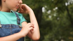 Devi notare un particolare: come distinguere il morso di un ragno da quello di una zanzara