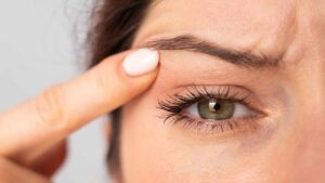 Palpebre cadenti: questi sono i rimedi naturali che fanno al caso tuo