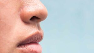 Effetto lucido sul viso? Risolvi così