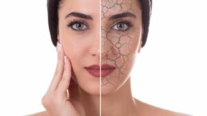 Cosa sono i radicali liberi e soprattutto come influiscono sulla salute? Di certo non immagini la risposta…