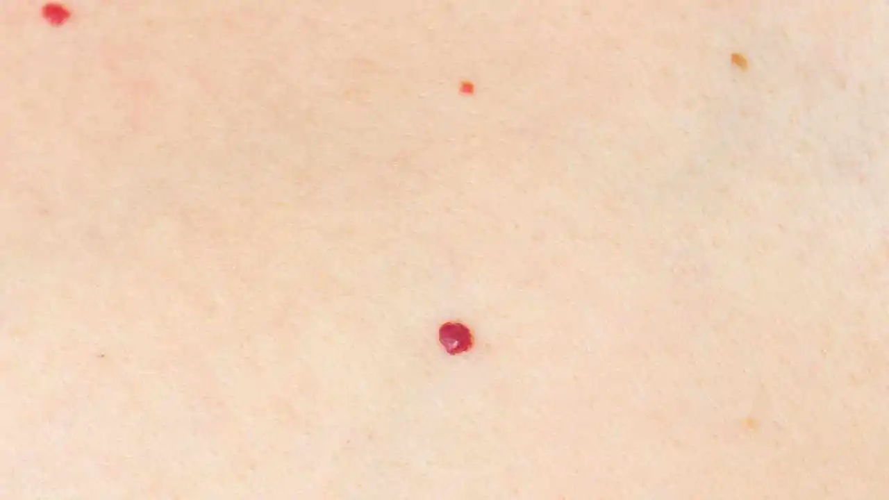 pelle e puntini rossi