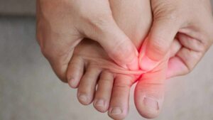Le malattie che causano dolore all’alluce