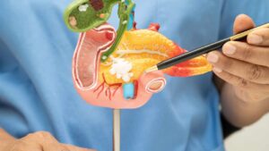 Tumore al pancreas, l’Oms avverte: “Ne aumenta il rischio”