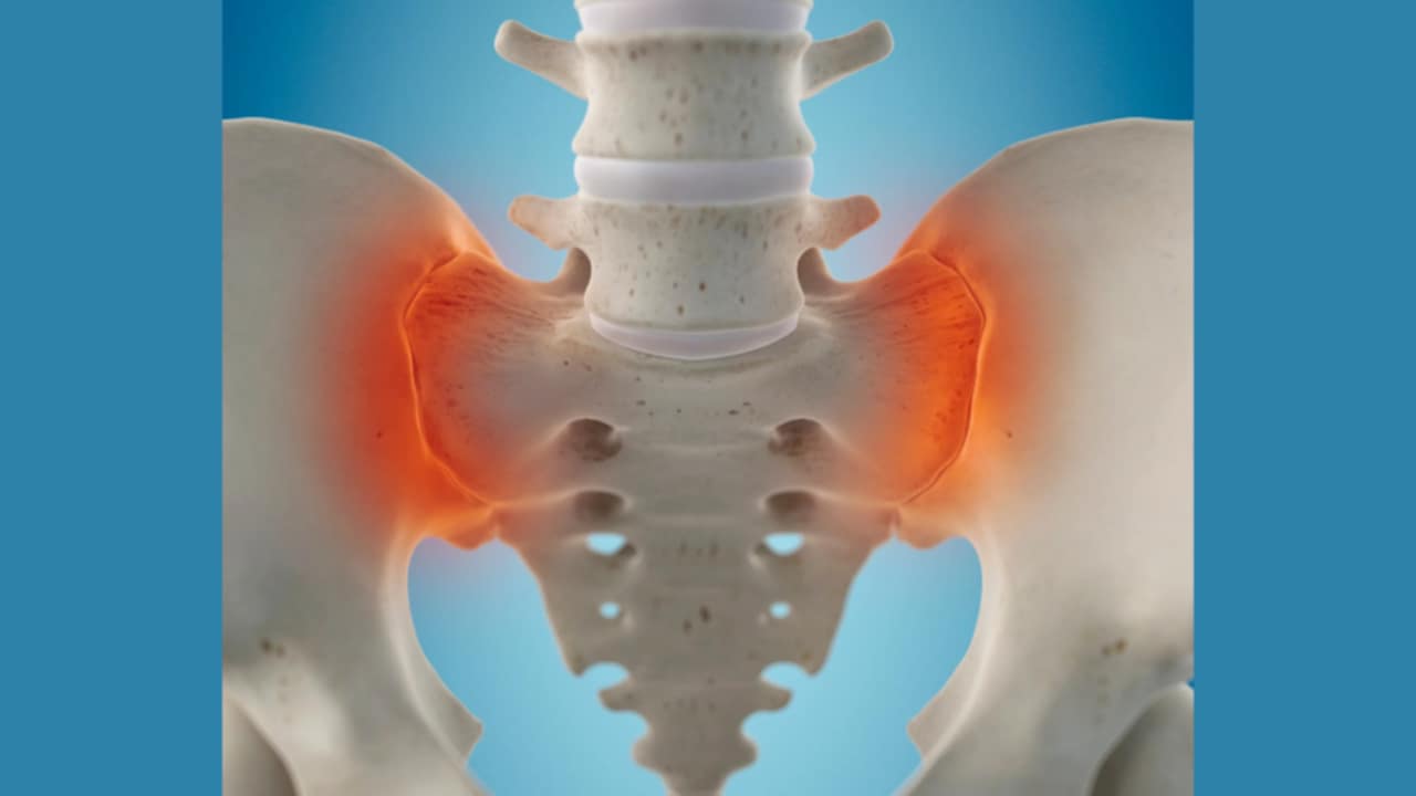 origini dolore sacro iliaco