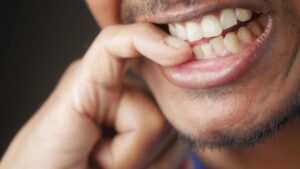 Trucchi efficaci per smettere di mangiarsi le unghie e migliorare la salute delle mani