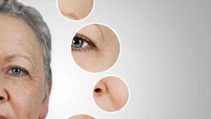 La vitamina di cui hai bisogno per contrastare le rughe del viso e come usarla