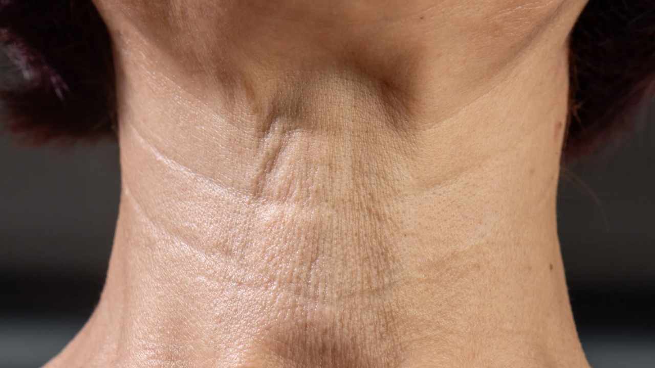 vitamina E per le rughe