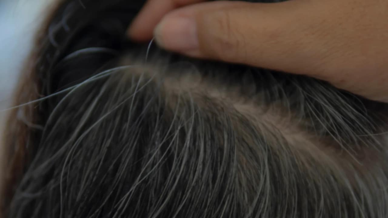 strappare capelli bianchi