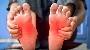 Ecco cosa dovresti sapere sei tuoi piedi presentano questi segnali