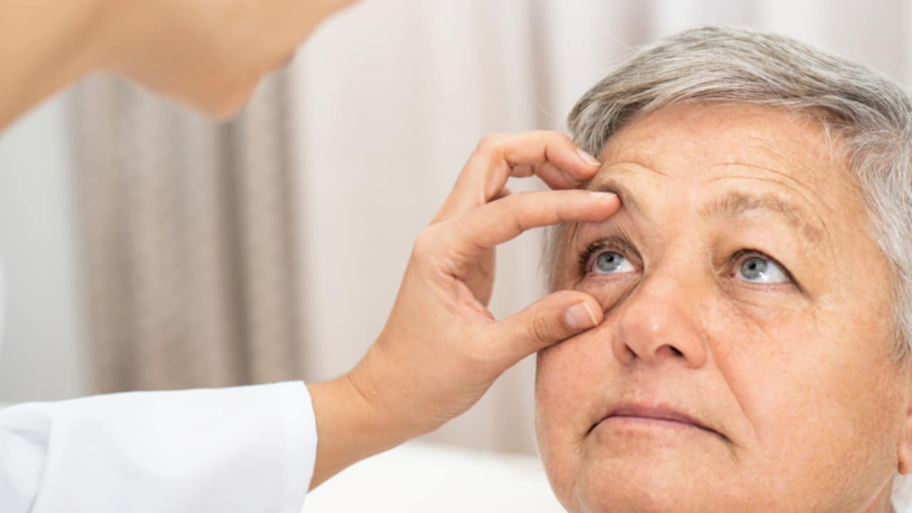 sintomi Melanoma oculare