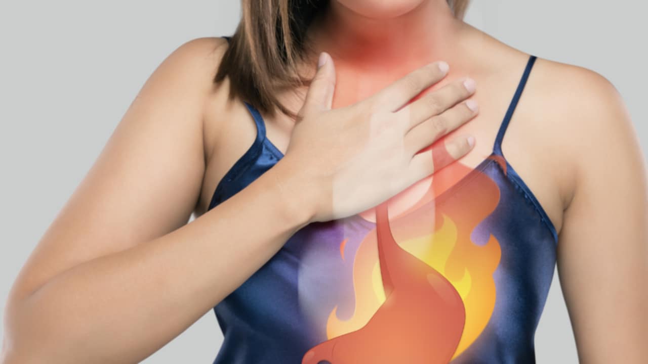 rimedi acidità stomaco