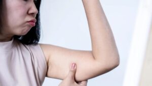 Come eliminare le braccia flaccide con metodi naturali e semplici