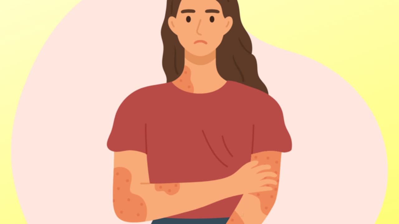 stress e fuoco di Sant'Antonio