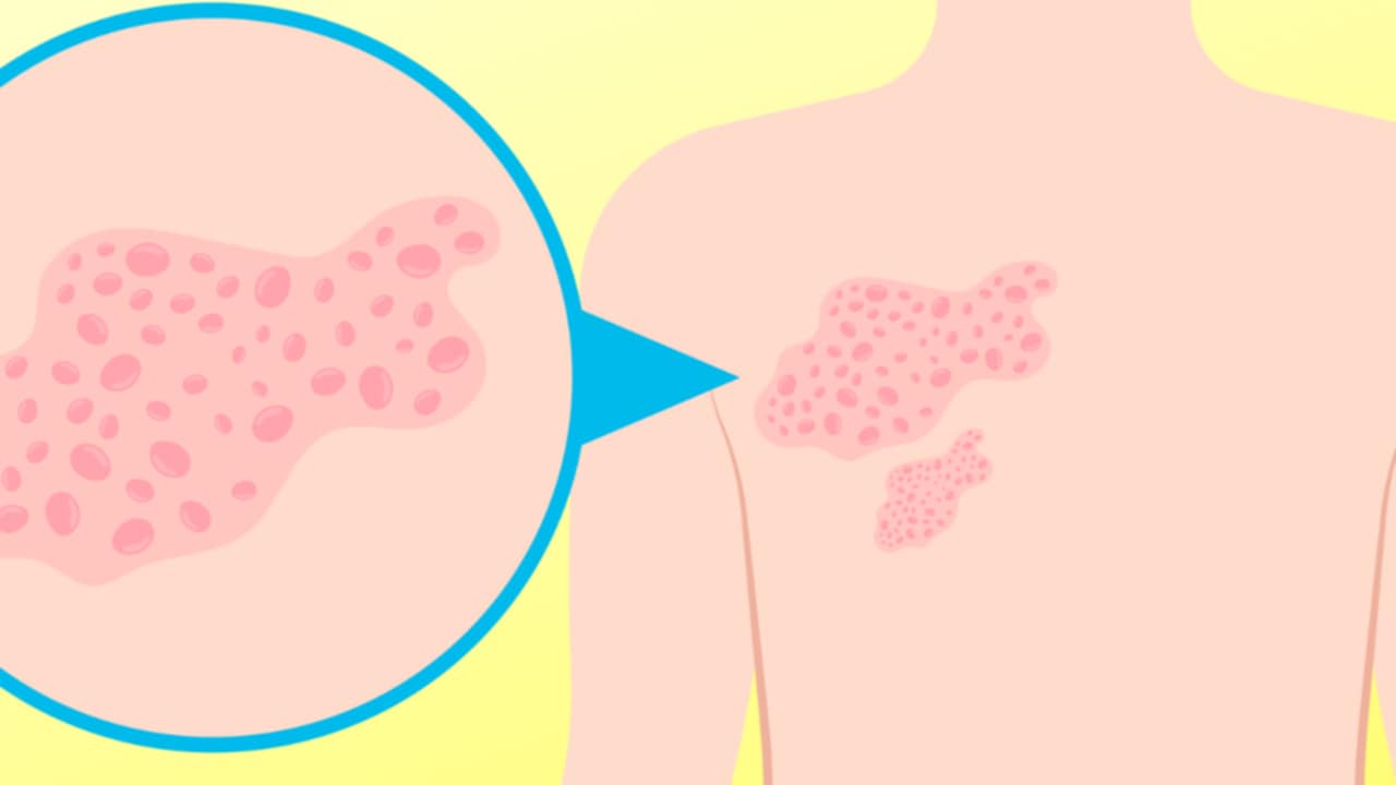 stress e fuoco di Sant'Antonio