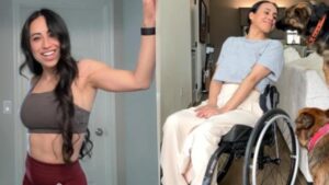 Un morso di zecca ha cambiato per sempre la vita di un’influencer. La babesiosi, una diagnosi poco conosciuta, che può colpire chiunque