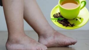 Fai QUESTO al mattino e le tue gambe non saranno più gonfie