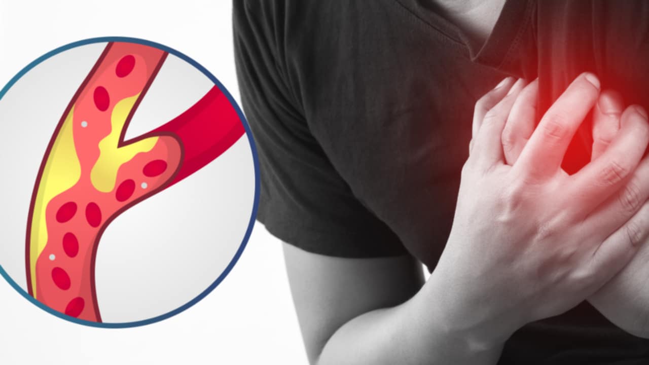 rimedi  salute cardiovascolare