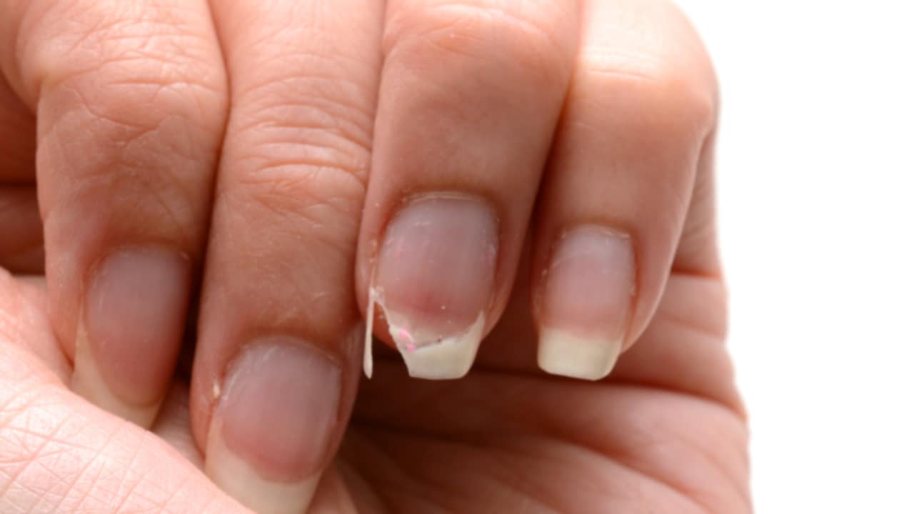 sintomi carenza si ferro