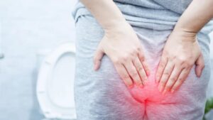 7 ottimi consigli per prevenire e trattare le emorroidi