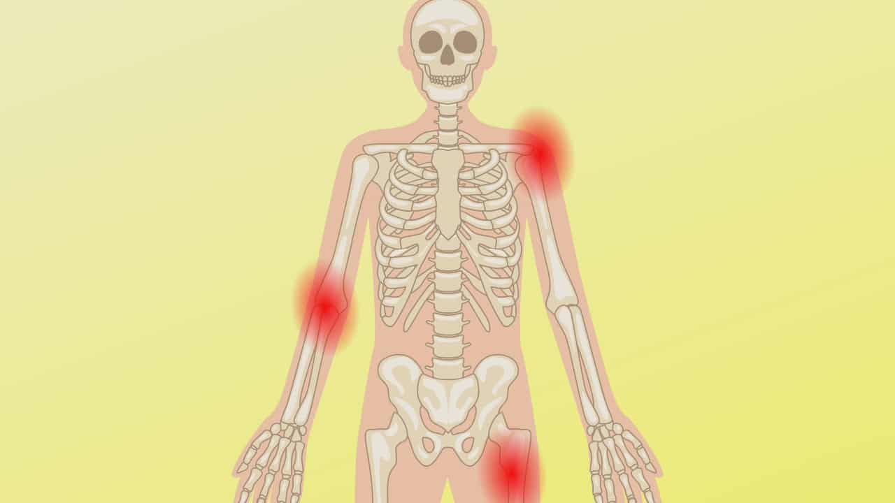 comuni malattie ossee