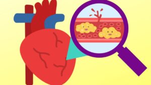 5 possibili cause di trigliceridi alti che dovresti assolutamente conoscere