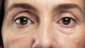 13 segnali sul tuo viso che ti avvertono di un problema di salute