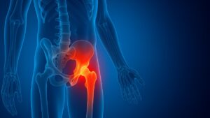 Gli alimenti che possono danneggiare la salute delle tue ossa