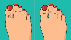 8 cose che i tuoi piedi possono rivelare sulla tua salute (che non dovresti assolutamente ignorare)