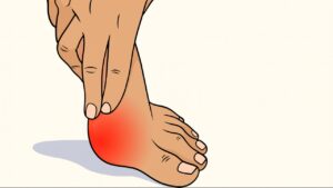 La maggior parte delle persone ignora i segnali che danno loro i piedi