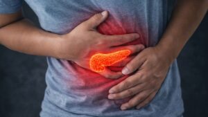 I primi 4 segnali del cancro al pancreas che devi assolutamente conoscere