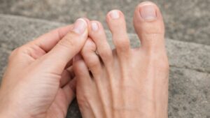 10 possibili cause del dolore alle dita dei piedi che dovresti conoscere