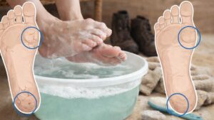 Immergi i tuoi piedi in questa miscela ogni 2 settimane e non avrai più problemi